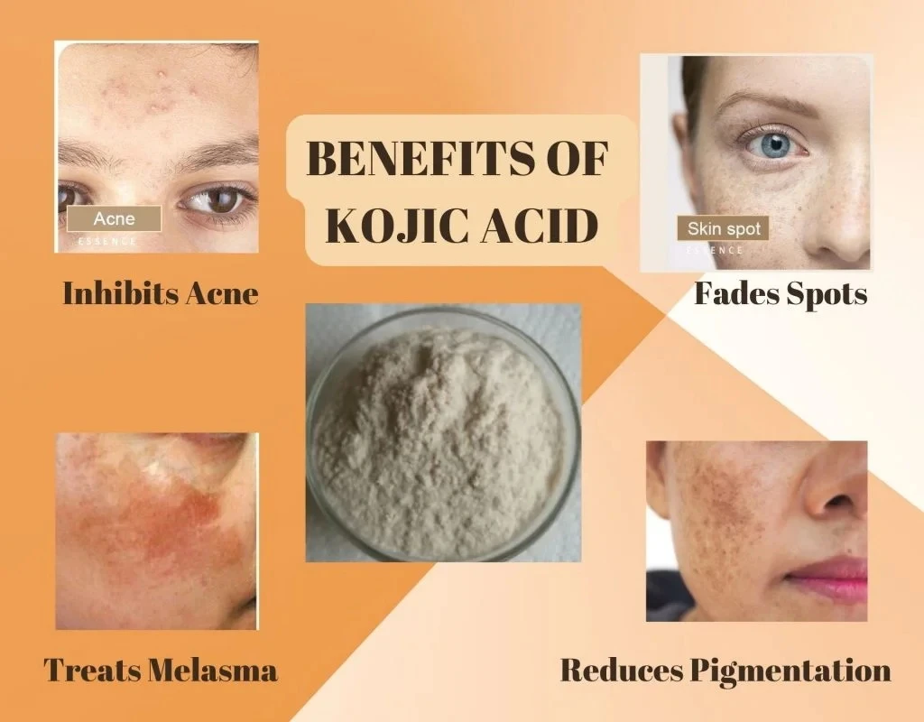 Benefits of kojic acid Benefits of kojic acid