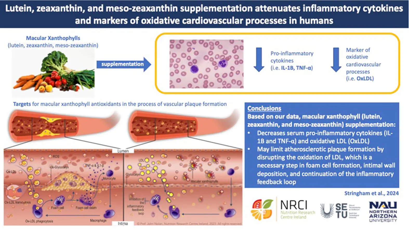 zeaxanthin blood pressure2 zeaxanthin blood pressure2